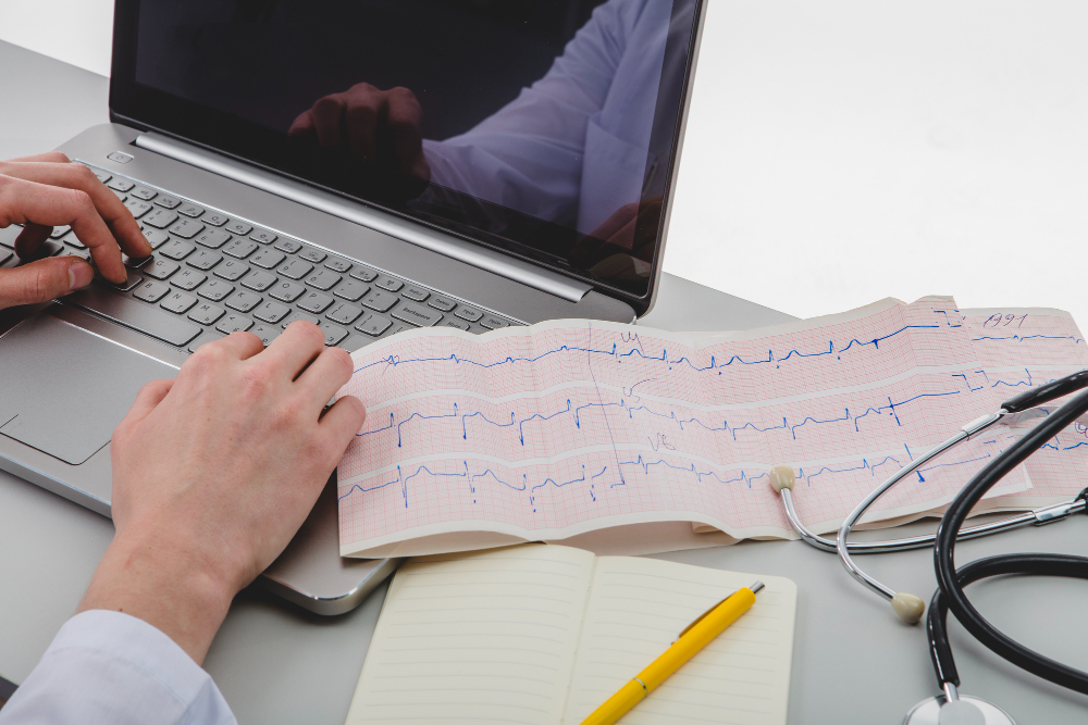 Arritmia aparece no eletrocardiograma